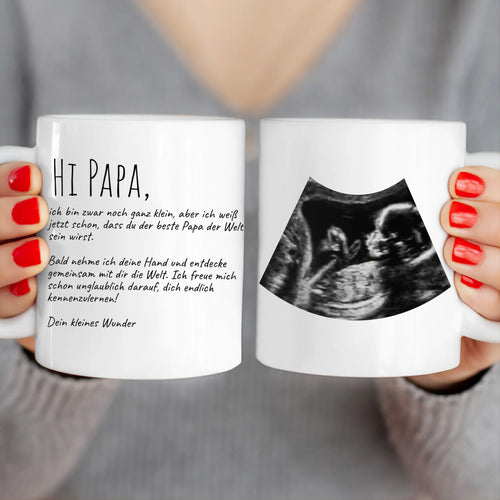 Personalisierte Tasse - Hi Papa, ich freu mich dich zu sehen... mit Ultraschallbild